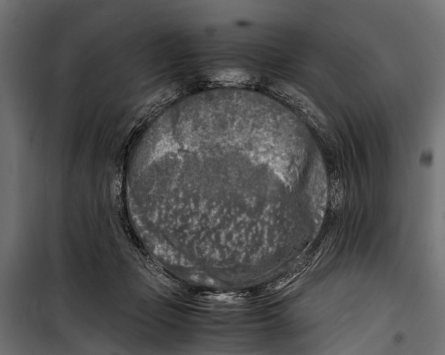 X0000099930365200806201102