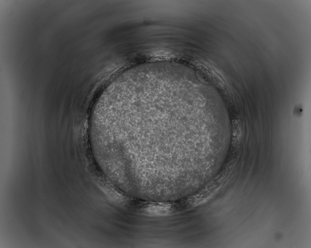 X0000099930369200806201102