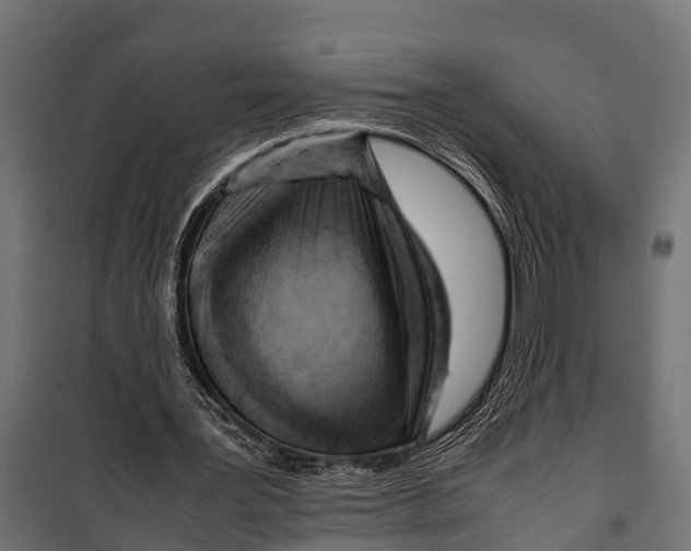 X0000099930387200806201102