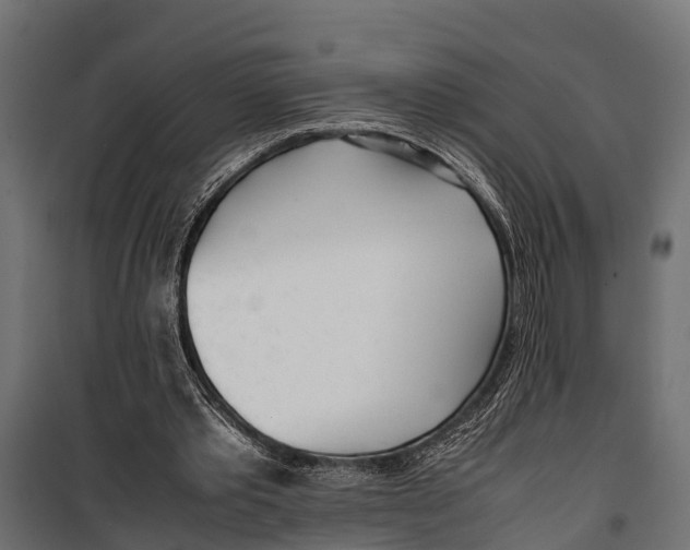 X0000099930389200806201102