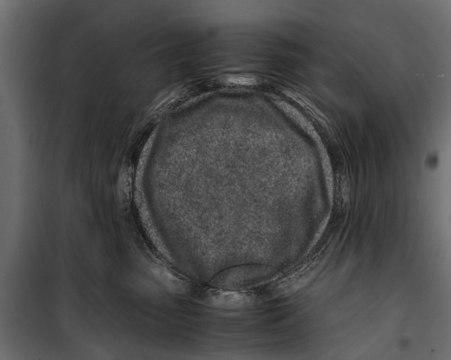 X0000099930475200806201101