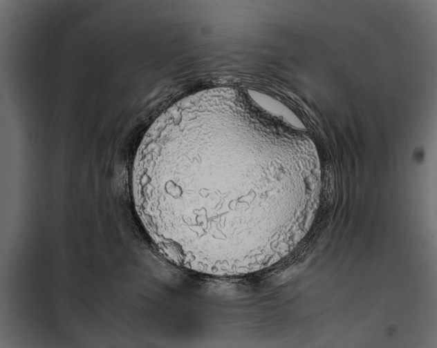 X0000099930523200806201100