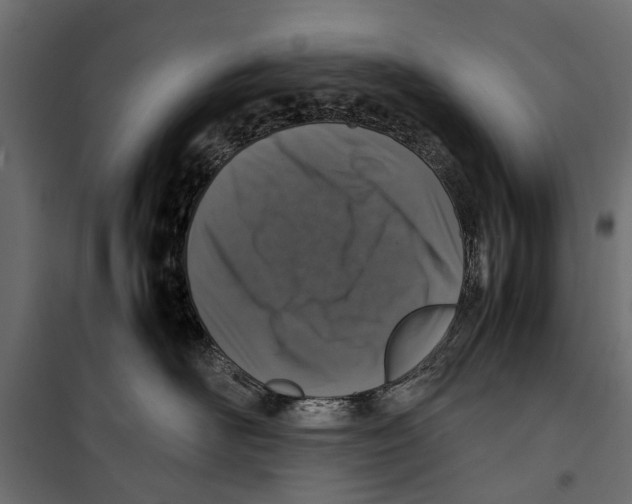 X0000099930526200806201100