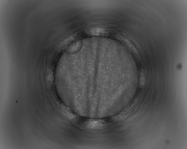 X0000099930569200806201059