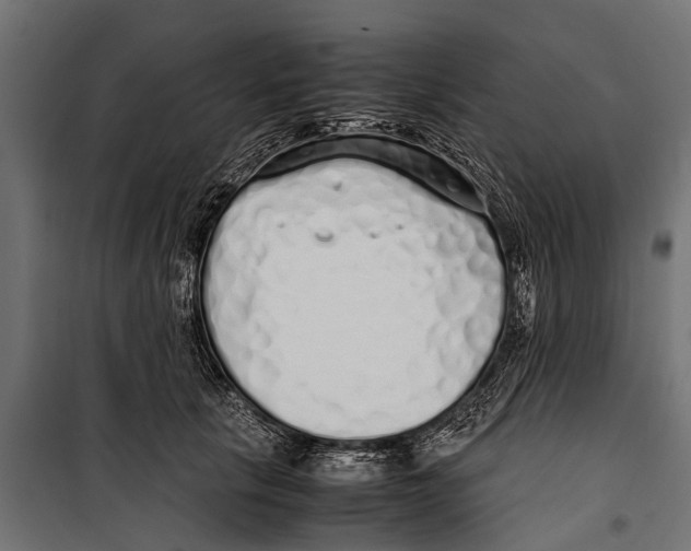 X0000099930657200806201058