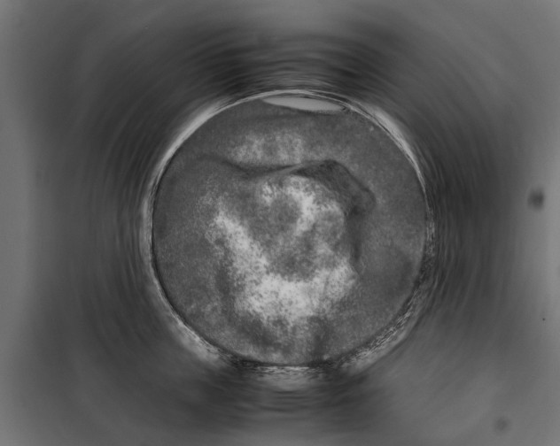 X0000099930859200806201055