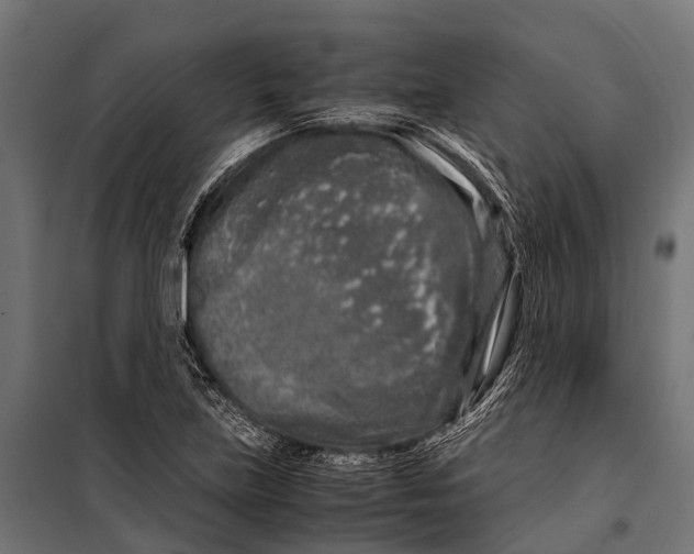 X0000099931219200806201049