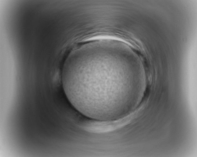 X0000099940029200805231301