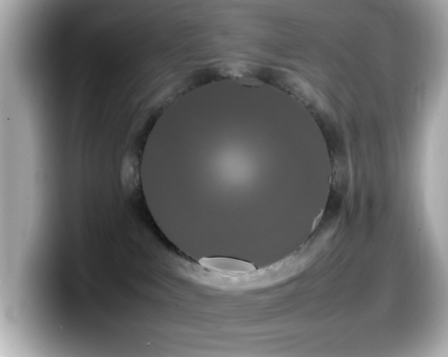 X0000099940043200805231301