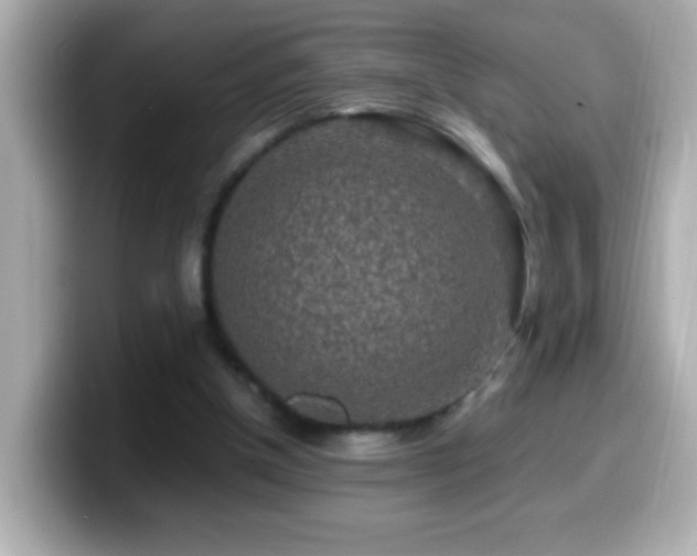 X0000099940154200805231259