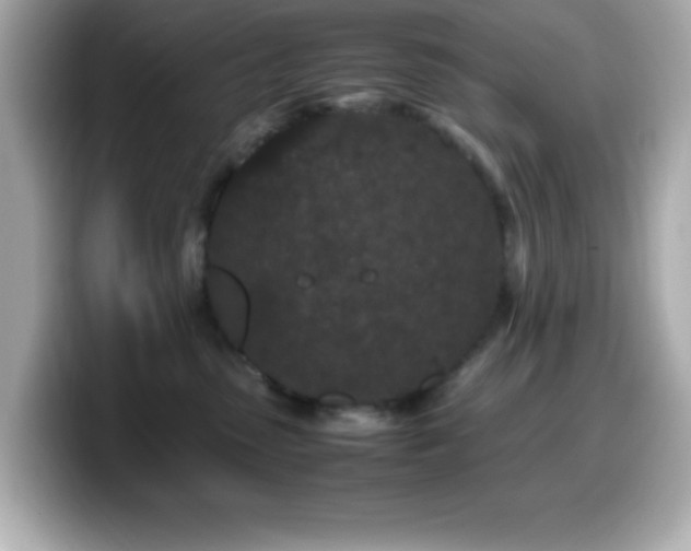 X0000099940475200805231255