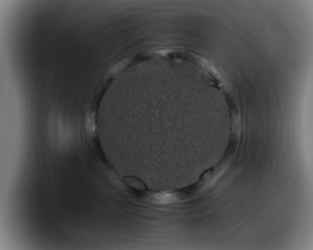 X0000099940383200805301222