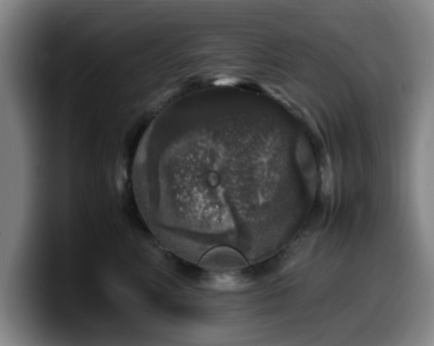 X0000099940618200805301218