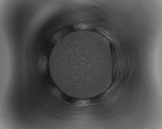 X0000099940760200805301217