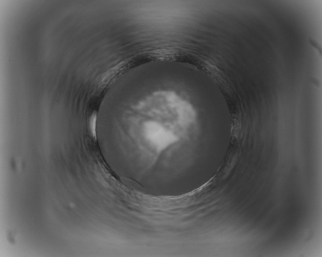 X0000099940047200806061529