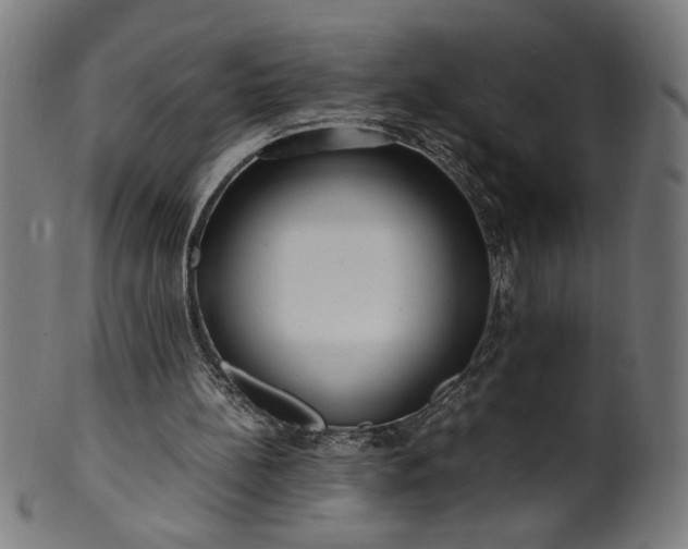 X0000099940148200806061526