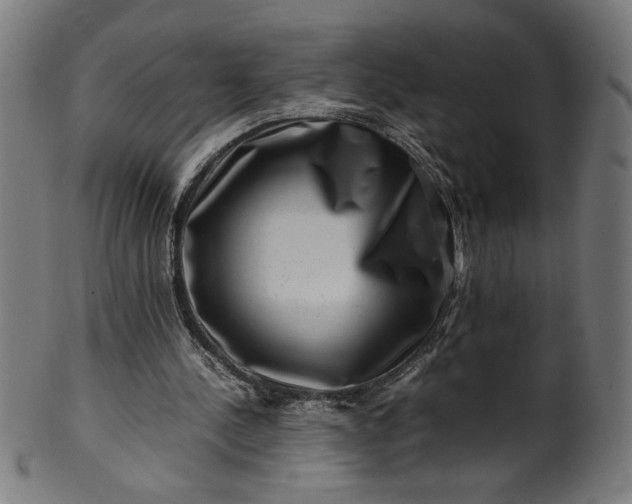 X0000099940244200806061525