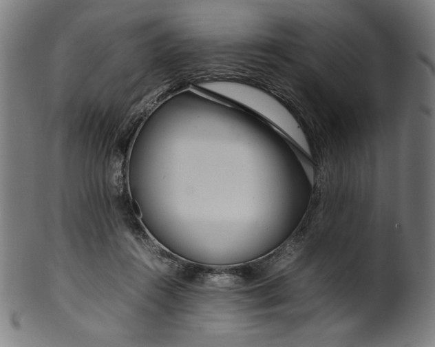 X0000099940360200806061524