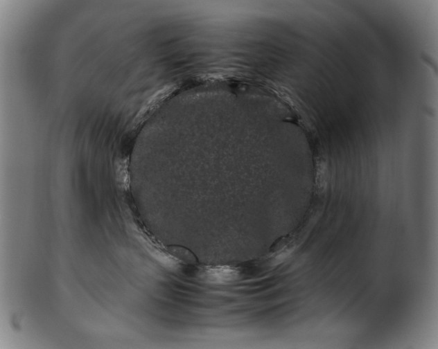 X0000099940383200806061524