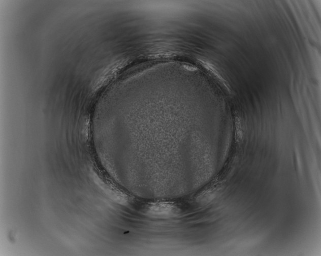 X0000099940451200806061522