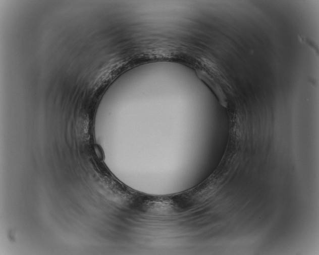X0000099940548200806061521