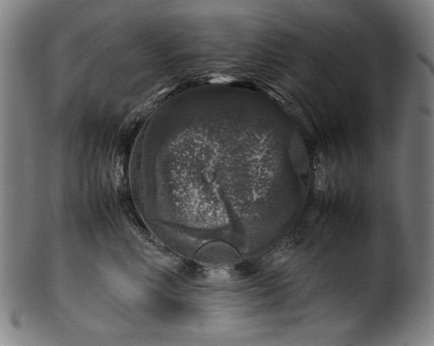 X0000099940618200806061520