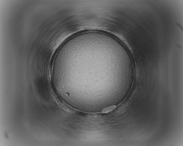 X0000099940887200806061515