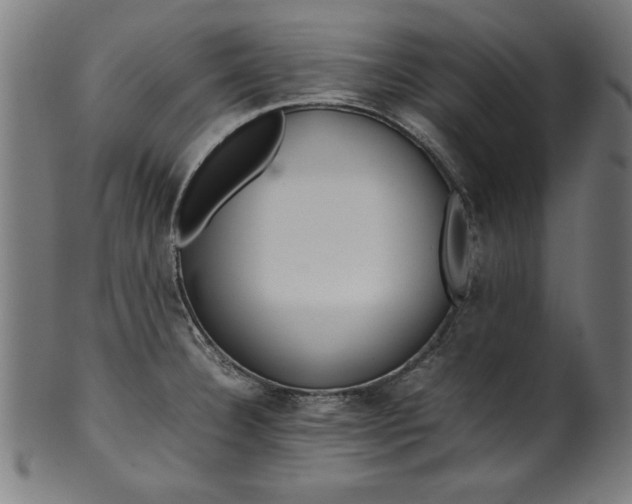 X0000099941332200806061509