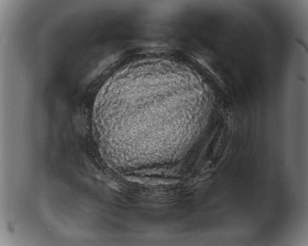 X0000099941399200806061507