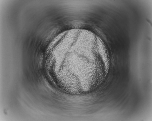 X0000099940018200806131435