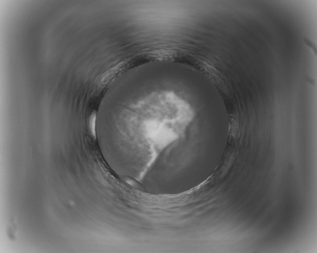 X0000099940047200806131435