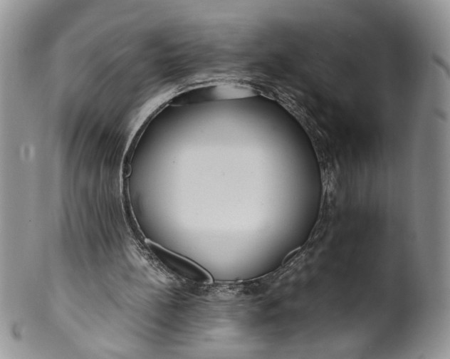 X0000099940148200806131433