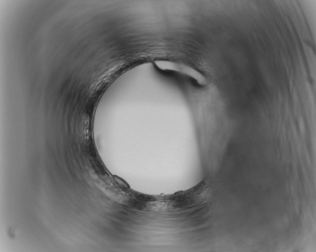 X0000099940356200806131430