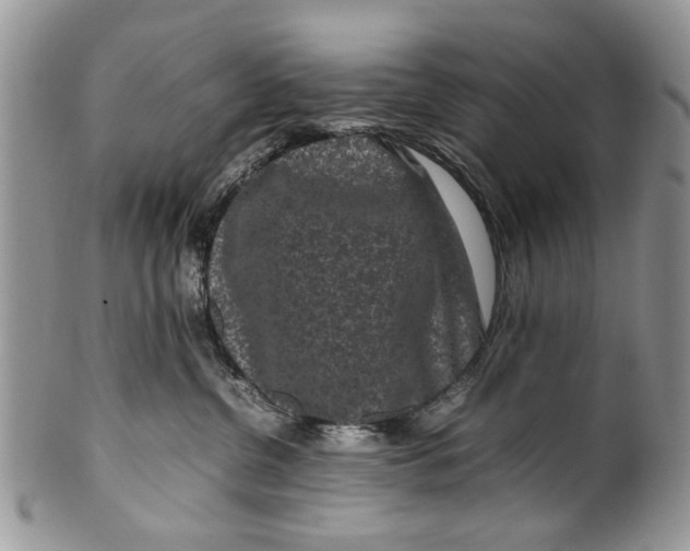 X0000099940380200806131431