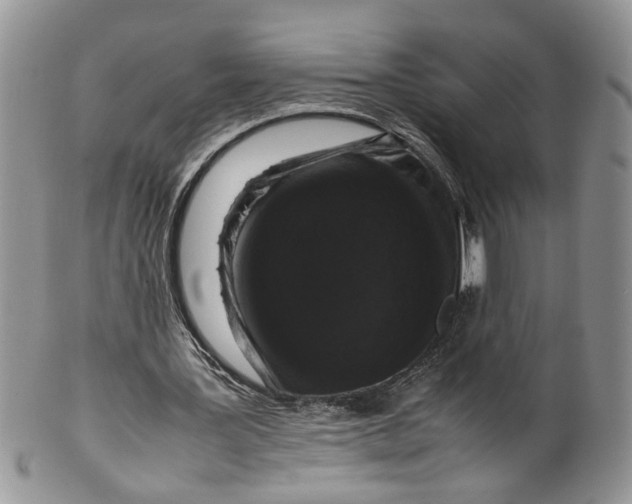 X0000099940387200806131430