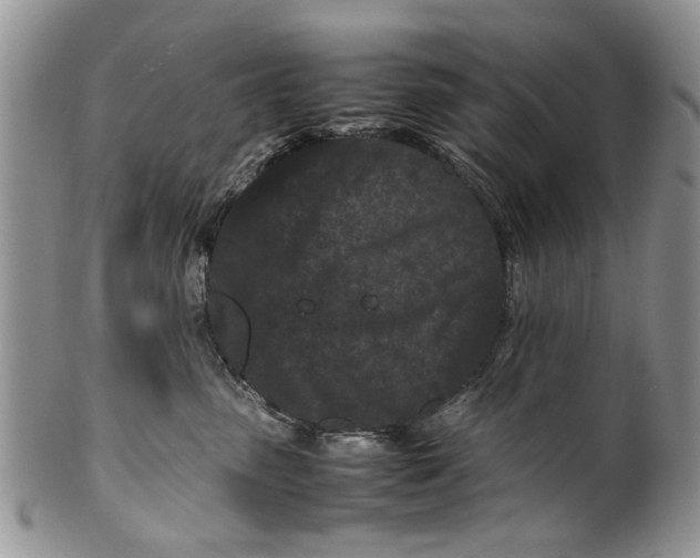 X0000099940475200806131429