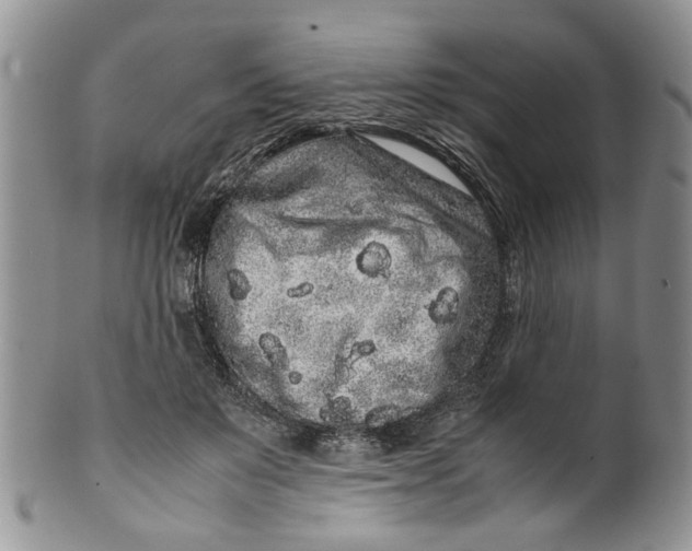 X0000099940503200806131428