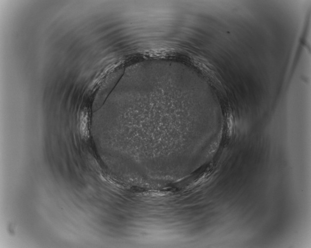 X0000099941060200806131420