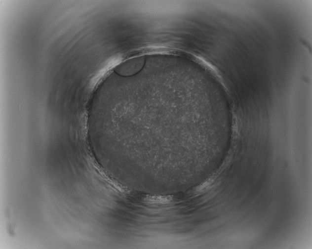 X0000099941411200806131415