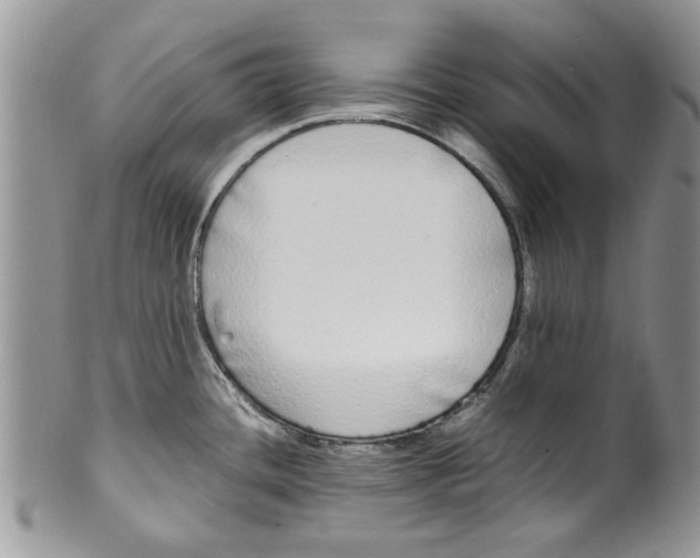 X0000099941436200806131415