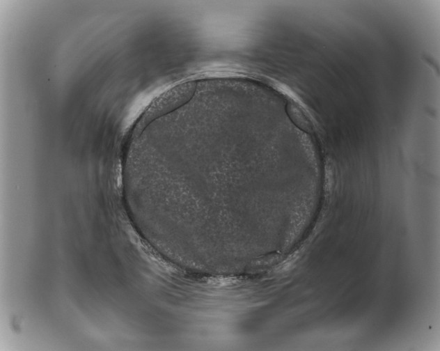 X0000099941461200806131414