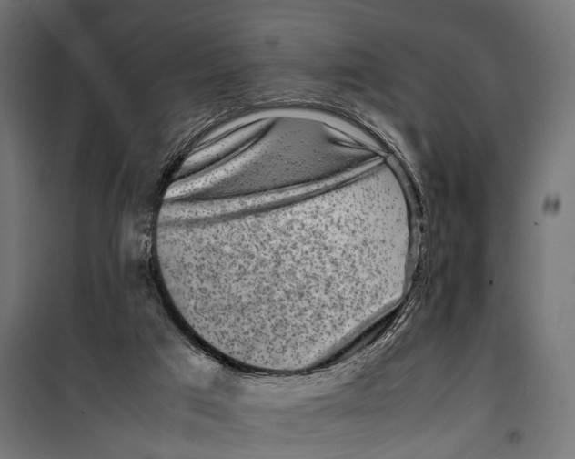 X0000099940017200806201131