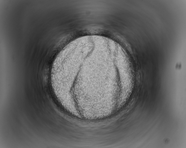 X0000099940018200806201131