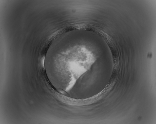 X0000099940047200806201131