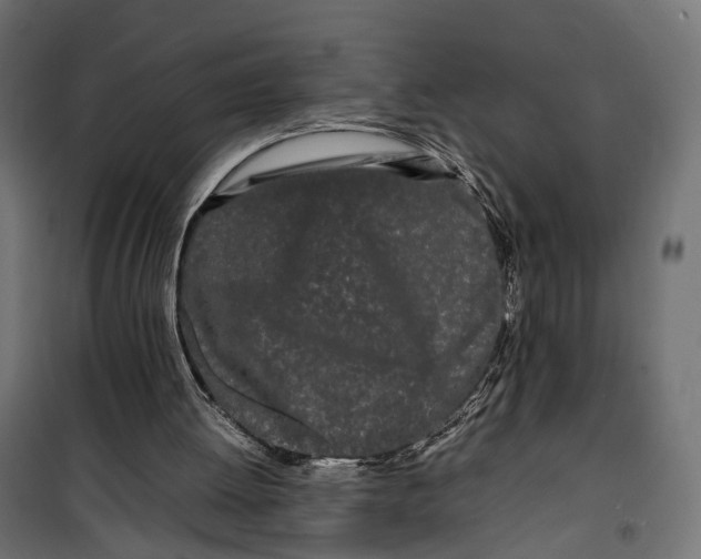 X0000099940052200806201130