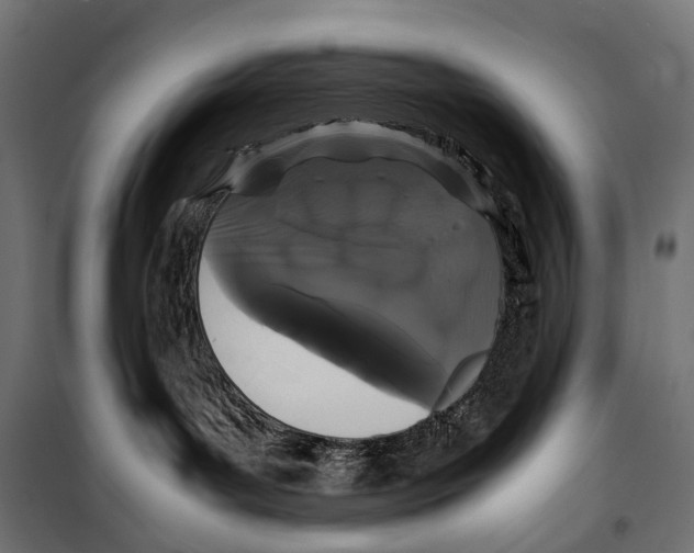 X0000099940143200806201129