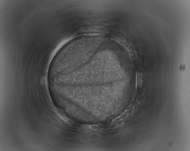 X0000099940147200806201128
