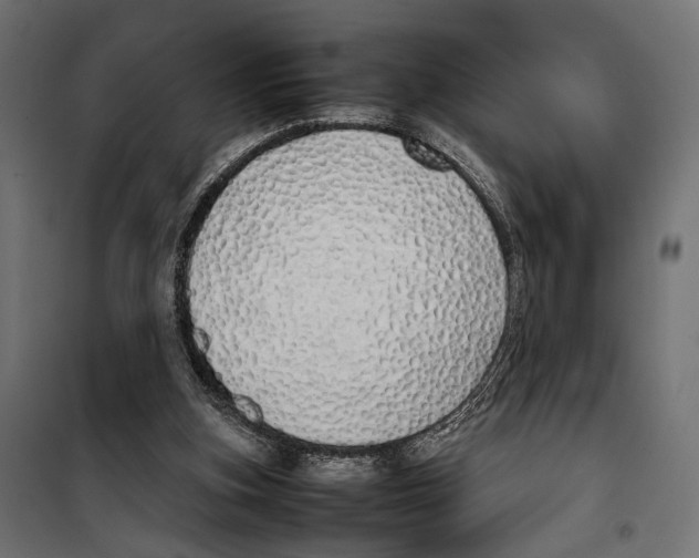 X0000099940155200806201129