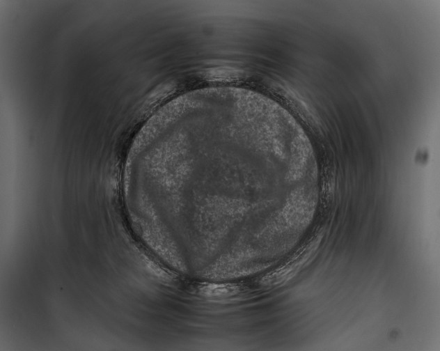 X0000099940277200806201128