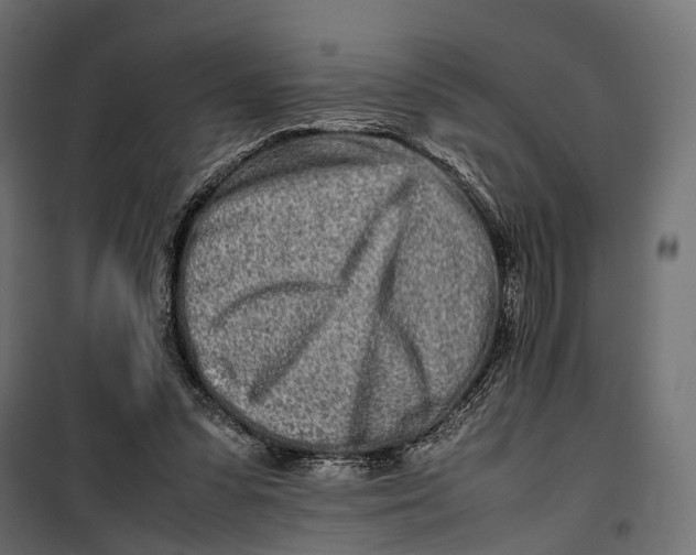 X0000099940303200806201127